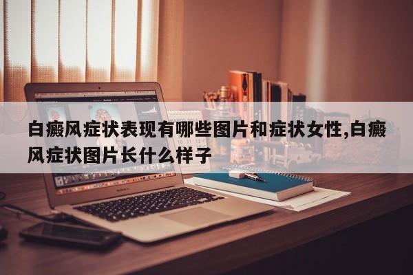 白癜风症状表现有哪些图片和症状女性,白癜风症状图片长什么样子