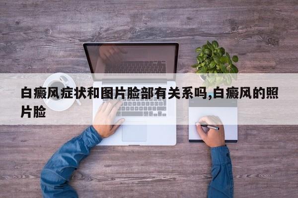 白癜风症状和图片脸部有关系吗,白癜风的照片脸