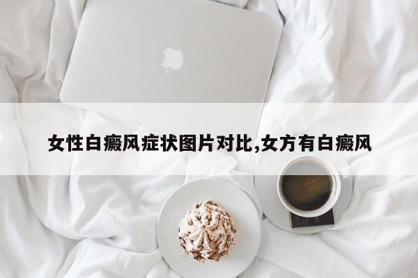 女性白癜风症状图片对比,女方有白癜风