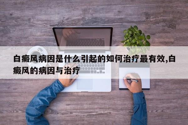 白癜风病因是什么引起的如何治疗最有效,白癜风的病因与治疗