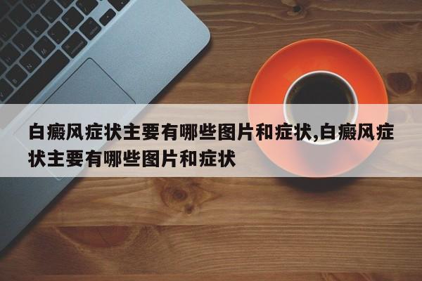 白癜风症状主要有哪些图片和症状,白癜风症状主要有哪些图片和症状