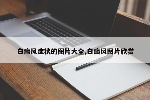 白癜风症状的图片大全,白癜风图片欣赏