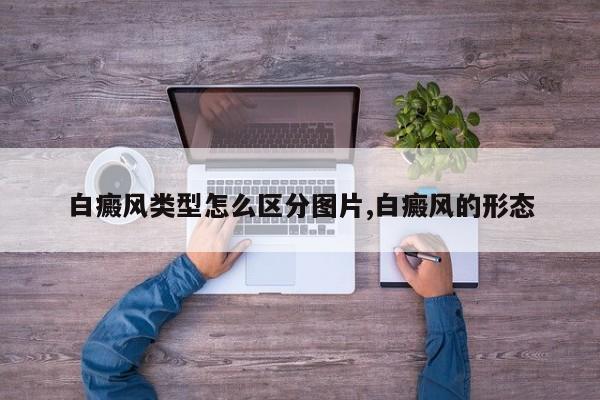 白癜风类型怎么区分图片,白癜风的形态