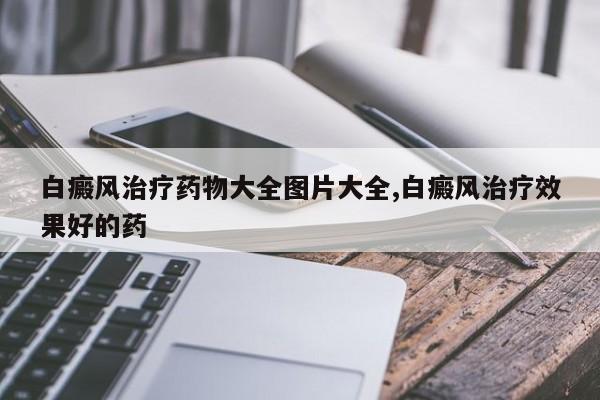 白癜风治疗药物大全图片大全,白癜风治疗效果好的药