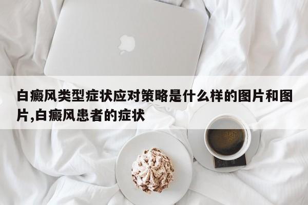 白癜风类型症状应对策略是什么样的图片和图片,白癜风患者的症状