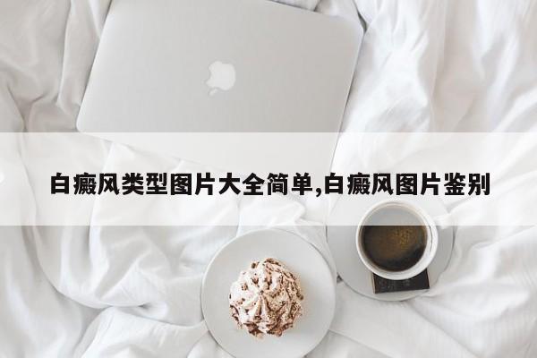 白癜风类型图片大全简单,白癜风图片鉴别
