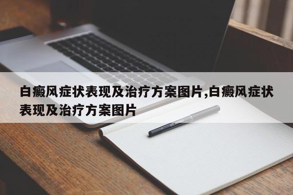 白癜风症状表现及治疗方案图片,白癜风症状表现及治疗方案图片
