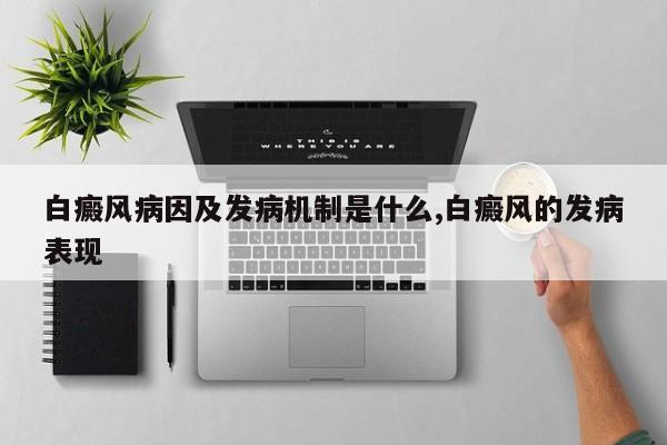 白癜风病因及发病机制是什么,白癜风的发病表现