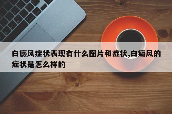 白癜风症状表现有什么图片和症状,白癜风的症状是怎么样的