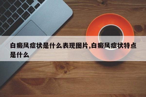 白癜风症状是什么表现图片,白癜风症状特点是什么