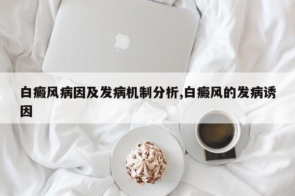 白癜风病因及发病机制分析,白癜风的发病诱因