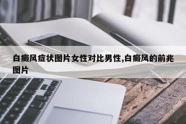 白癜风症状图片女性对比男性,白癜风的前兆图片