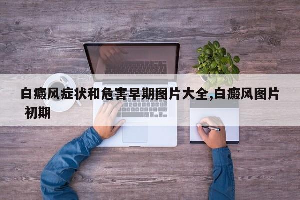 白癜风症状和危害早期图片大全,白癜风图片 初期