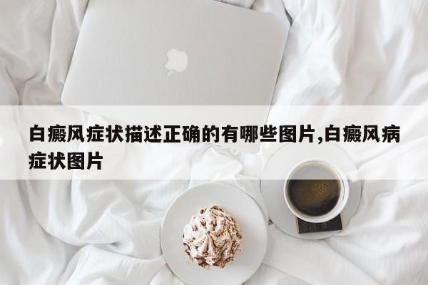 白癜风症状描述正确的有哪些图片,白癜风病症状图片