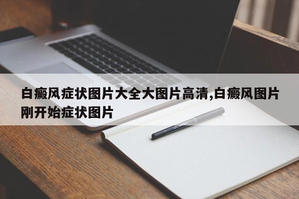 白癜风症状图片大全大图片高清,白癜风图片刚开始症状图片