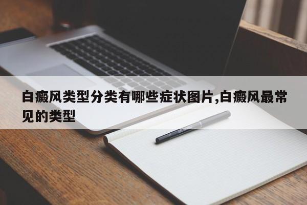 白癜风类型分类有哪些症状图片,白癜风最常见的类型