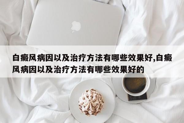 白癜风病因以及治疗方法有哪些效果好,白癜风病因以及治疗方法有哪些效果好的