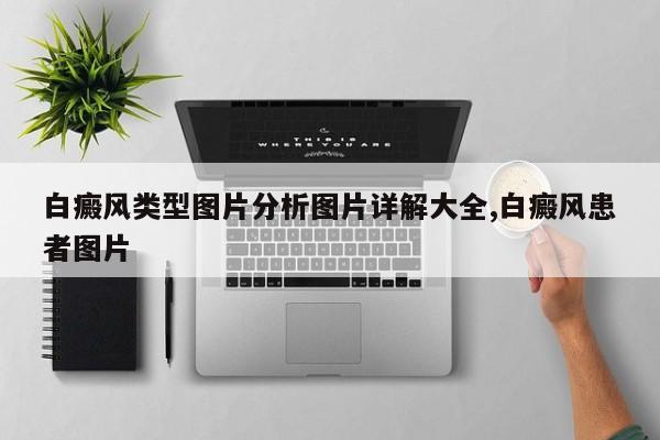 白癜风类型图片分析图片详解大全,白癜风患者图片