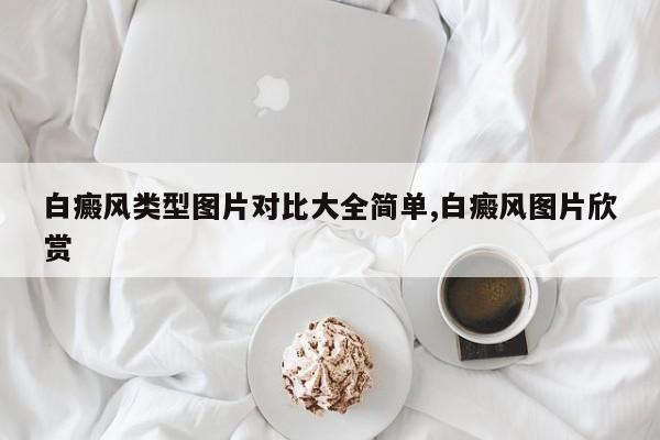 白癜风类型图片对比大全简单,白癜风图片欣赏