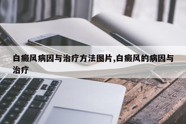 白癜风病因与治疗方法图片,白癜风的病因与治疗