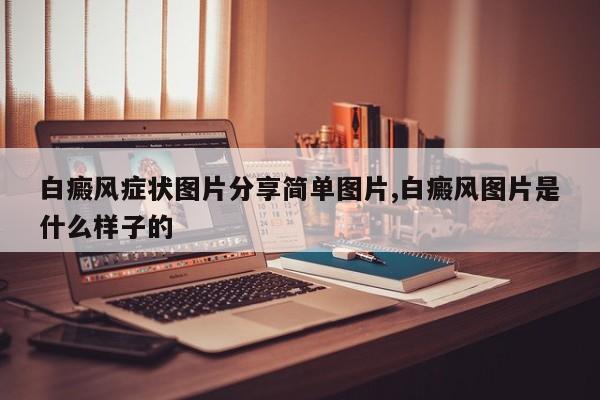 白癜风症状图片分享简单图片,白癜风图片是什么样子的
