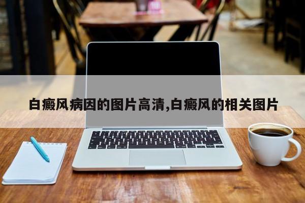 白癜风病因的图片高清,白癜风的相关图片