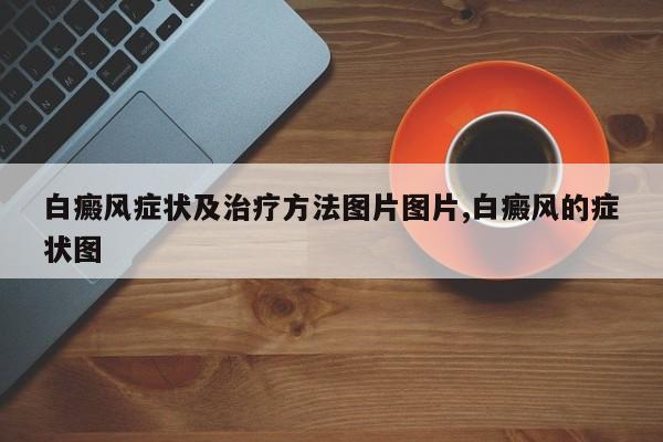 白癜风症状及治疗方法图片图片,白癜风的症状图