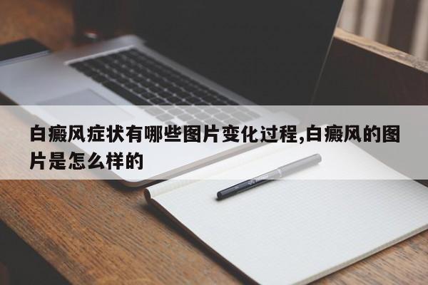 白癜风症状有哪些图片变化过程,白癜风的图片是怎么样的