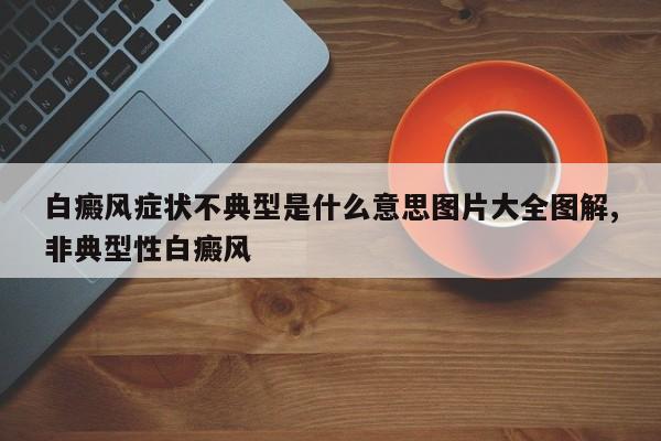 白癜风症状不典型是什么意思图片大全图解,非典型性白癜风
