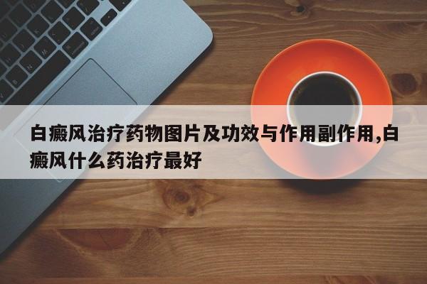 白癜风治疗药物图片及功效与作用副作用,白癜风什么药治疗最好