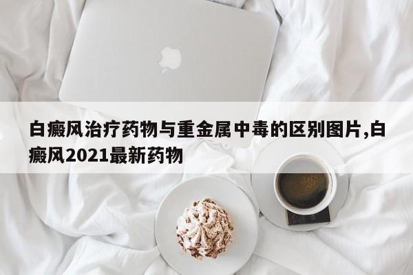 白癜风治疗药物与重金属中毒的区别图片,白癜风2021最新药物