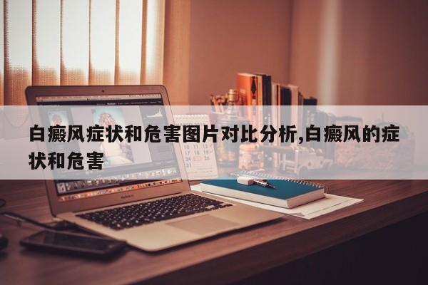 白癜风症状和危害图片对比分析,白癜风的症状和危害