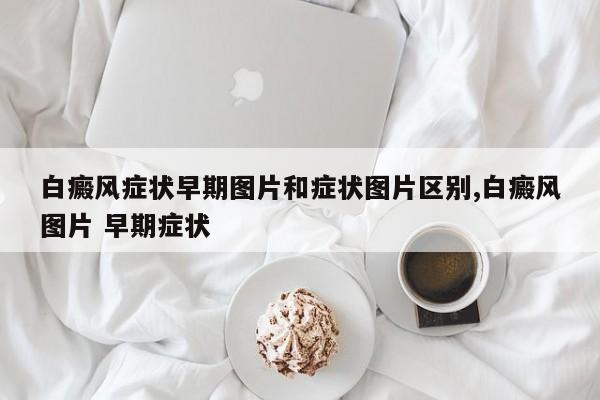 白癜风症状早期图片和症状图片区别,白癜风图片 早期症状