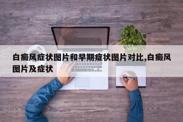 白癜风症状图片和早期症状图片对比,白癜风图片及症状