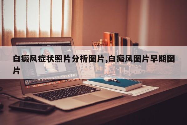 白癜风症状照片分析图片,白癜风图片早期图片