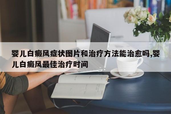 婴儿白癜风症状图片和治疗方法能治愈吗,婴儿白癜风最佳治疗时间