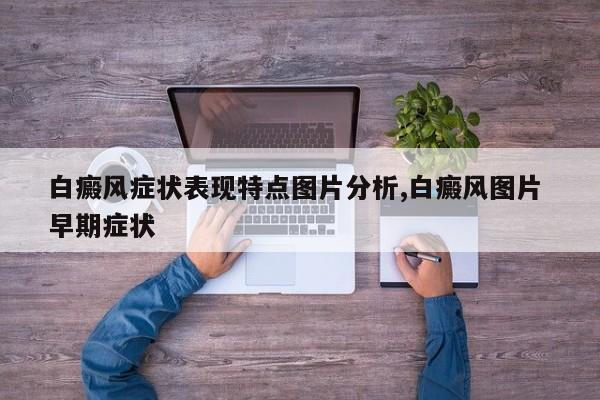 白癜风症状表现特点图片分析,白癜风图片 早期症状