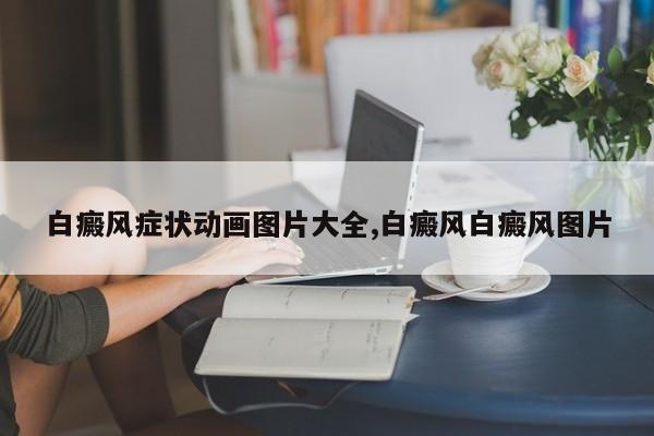 白癜风症状动画图片大全,白癜风白癜风图片