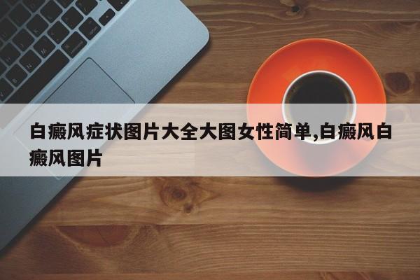 白癜风症状图片大全大图女性简单,白癜风白癜风图片
