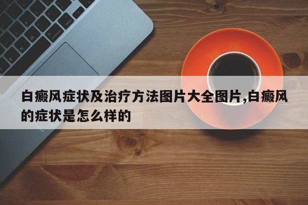 白癜风症状及治疗方法图片大全图片,白癜风的症状是怎么样的