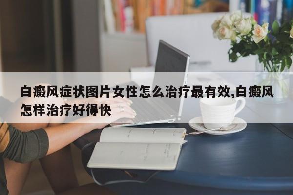 白癜风症状图片女性怎么治疗最有效,白癜风怎样治疗好得快