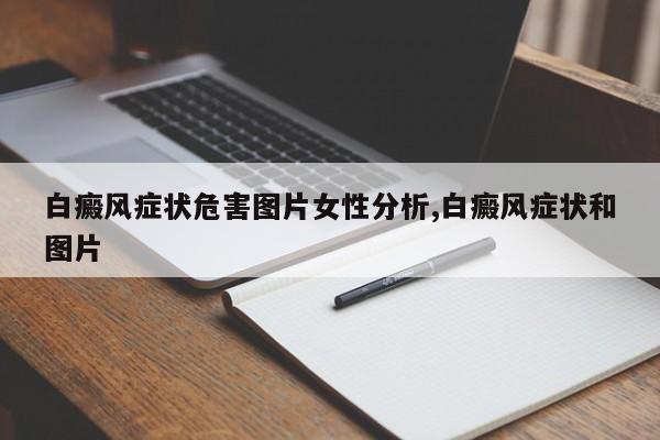 白癜风症状危害图片女性分析,白癜风症状和图片