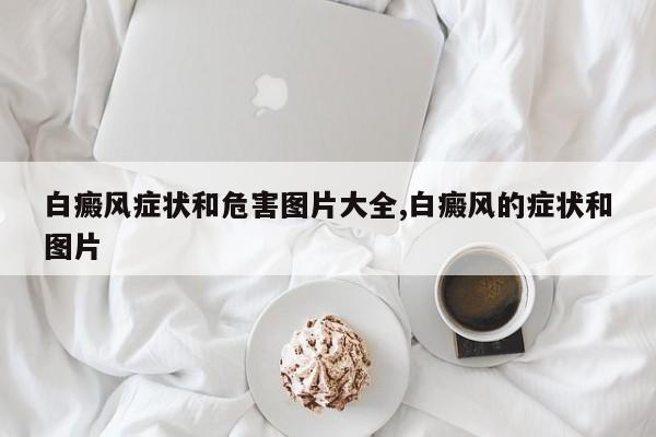 白癜风症状和危害图片大全,白癜风的症状和图片