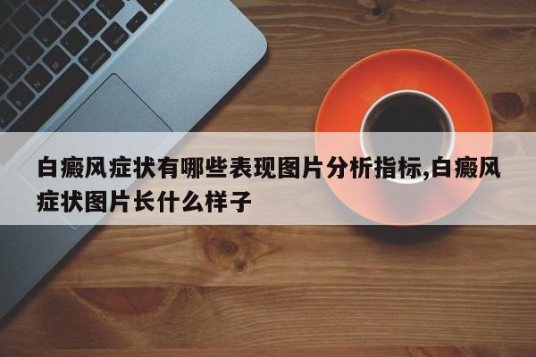 白癜风症状有哪些表现图片分析指标,白癜风症状图片长什么样子