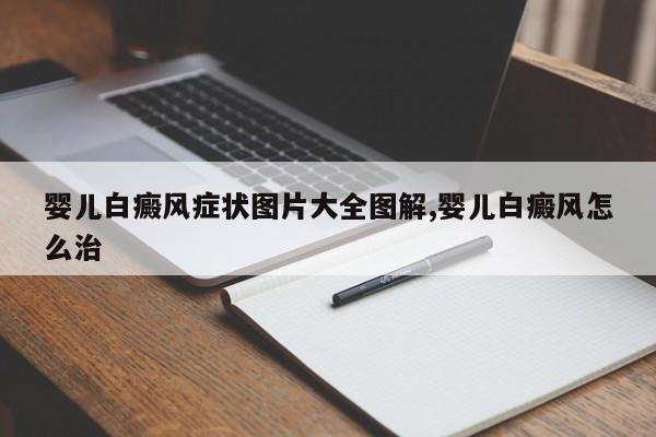 婴儿白癜风症状图片大全图解,婴儿白癜风怎么治
